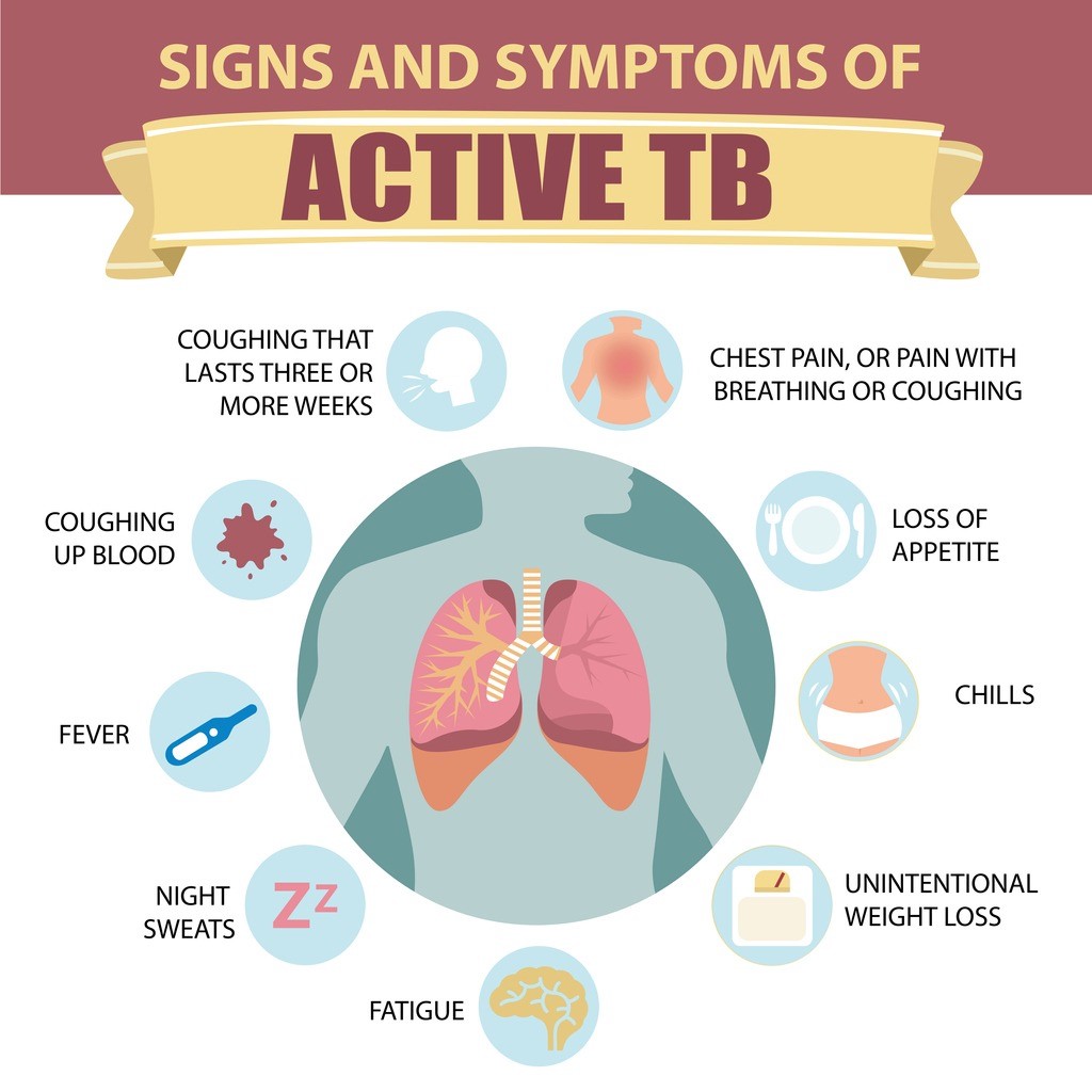 Tuberculosis Diagnosis Chart